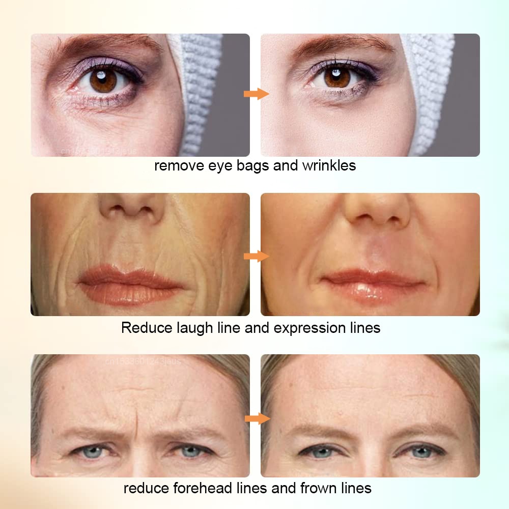 Face Skin Tightening Machine Lifting Device For Wrinkle Anti Aging